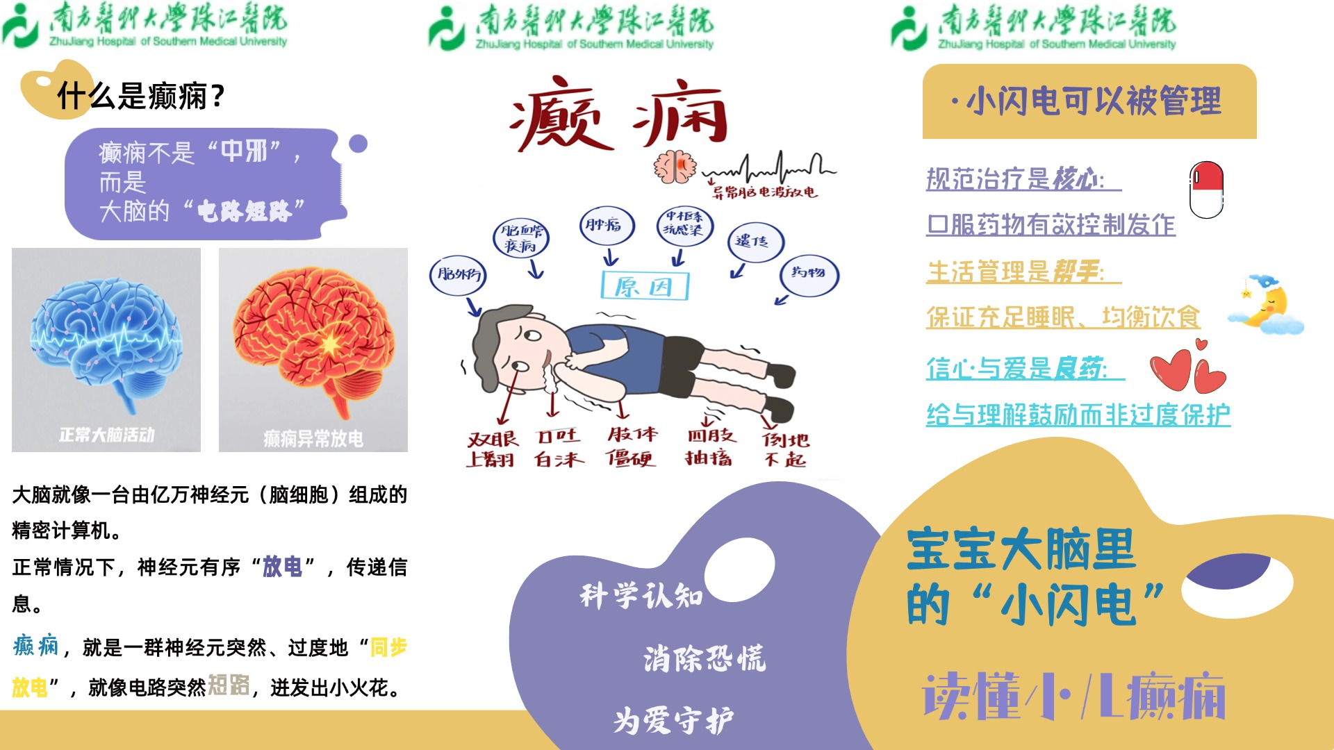 宝宝大脑里的“小闪电”：读懂小儿癫痫