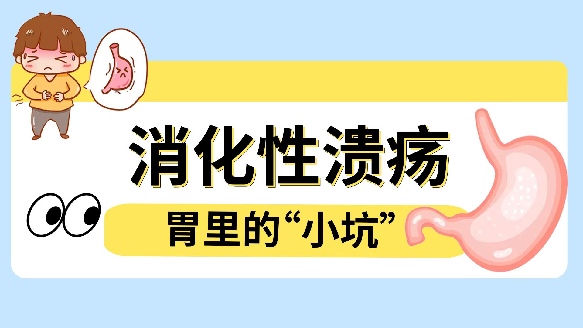 消化性溃疡：胃里的“小坑”