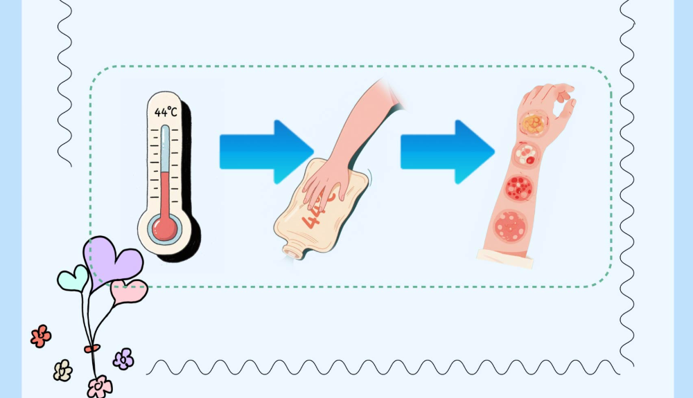 凛凛寒冬隐藏的温柔陷阱——低温烫伤