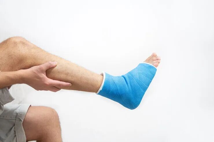 27e9e26d6ca81117effa795ff60ce764_blue-splint-ankle-bandaged-leg-cast-male-patient-white-background-isolated-sports-injury-concept_169016-7237_ga=GA1.1.3307806.1777725914&semt=ais_hybrid&w=740&q=80.jpg
